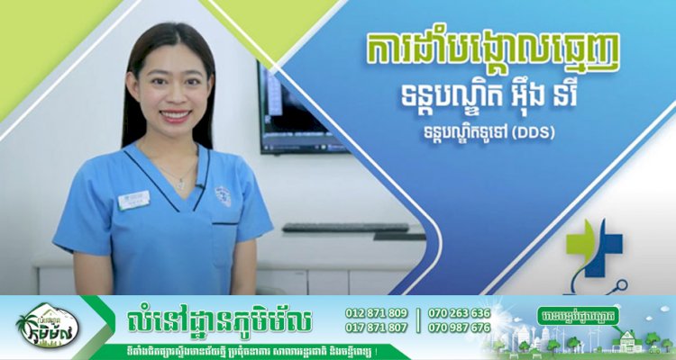 [វីដេអូ] Ep.11 # ប្រធានបទ៖ ការដាំបង្គោលធ្មេញ