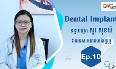 [វីដេអូ] Ep.10 ប្រធានបទ៖ Dental implant