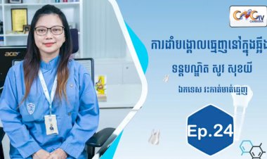 [វីដេអូ] Ep.24 ប្រធានបទ៖ ការដាំបង្គោលធ្មេញនៅក្នុងឆ្អឹង