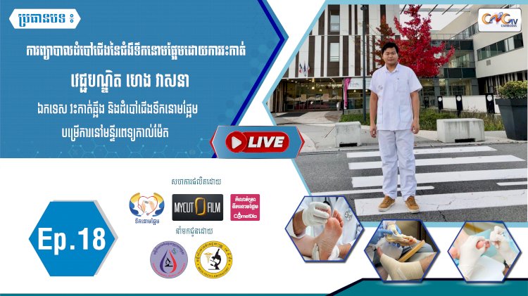 [វីដេអូ] Ep.18 ប្រធានបទ៖ ការព្យាបាលដំបៅជើងនៃជំងឺទឹកនោមផ្អែមដោយការវះកាត់