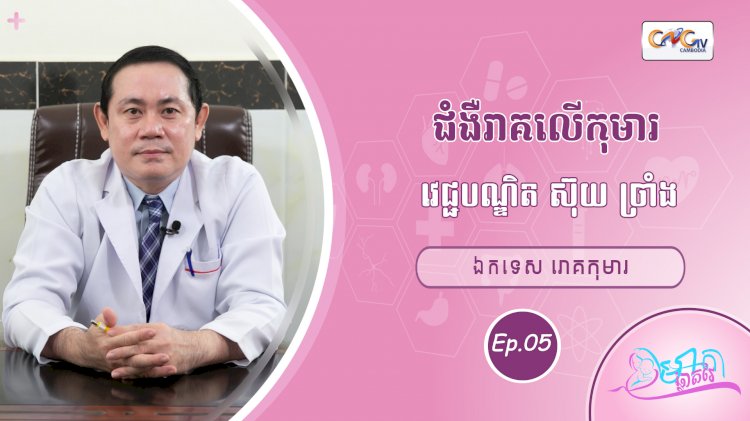 CNGTV | កម្មវិធី មាតាឆ្លាតវៃ Ep.05 ជំងឺរាគលើកុមារ