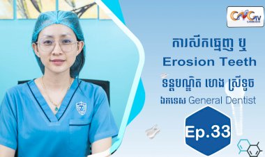 [វីដេអូ] Ep.33 ប្រធានបទ៖ សឹកធ្មេញ ឬ Erosion Teeth