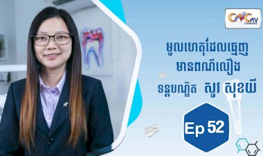 [វីដេអូ] Ep.52 ប្រធានបទ៖ មូលហេតុដែលធ្វើឲ្យធ្មេញមានពណ៌លឿង