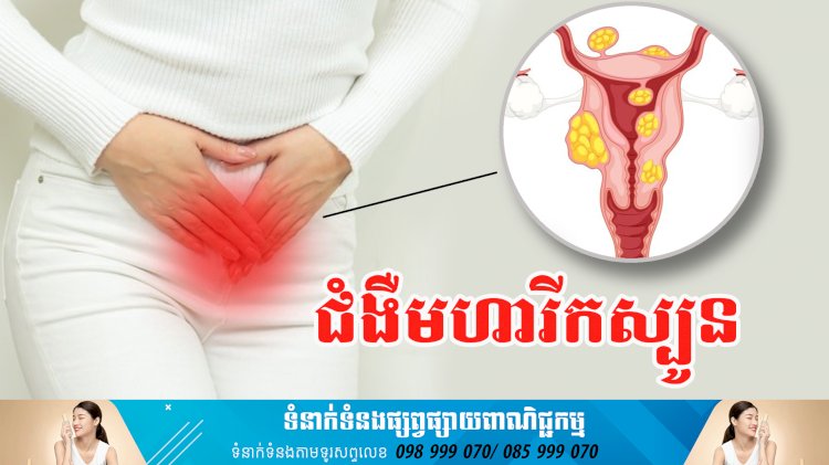 ប្រធានបទ ៖ ជំងឺមហារីកស្បូន