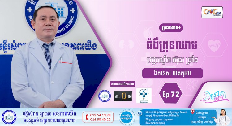 CNGTV | កម្មវិធី មាតាឆ្លាតវៃ Ep.72 ប្រធានបទ៖ ជំងឺគ្រុនឈាម