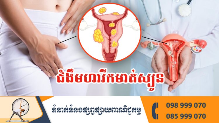 ប្រធានបទ ៖ ជំងឺមហារីកមាត់ស្បូន