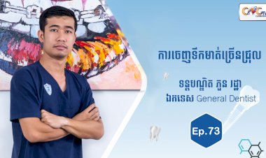 [វីដេអូ] Ep.73 ប្រធានបទ៖ ការចេញទឹកមាត់ច្រើនជ្រុល