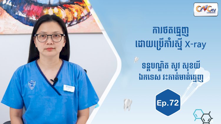 [វីដេអូ] Ep.72 ប្រធានបទ៖ ការថតធ្មេញដោយប្រើកាំរស្មី X-ray