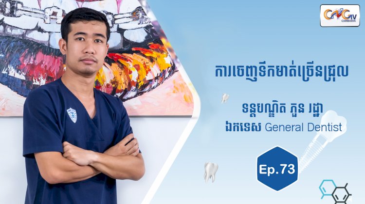 [វីដេអូ] Ep.73 ប្រធានបទ៖ ការចេញទឹកមាត់ច្រើនជ្រុល