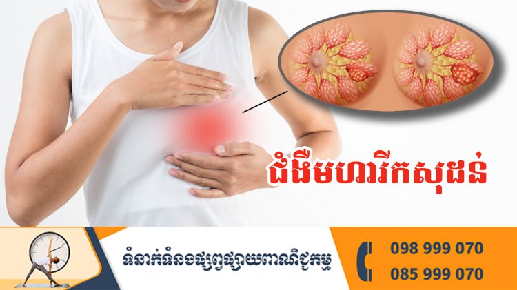 ប្រធានបទ ៖ ជំងឺមហារីកសុដន់